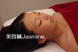 美容鍼Jasmine